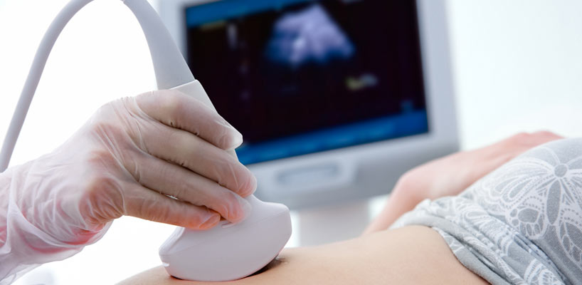 gravid scannes for forliggende moderkage