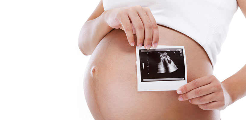 gravid kvinde med ultralyds scannings billede